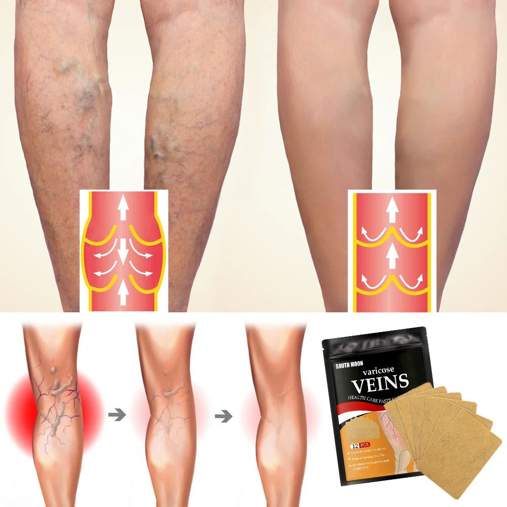 4 CAJAS DE PARCHES PARA VARICES